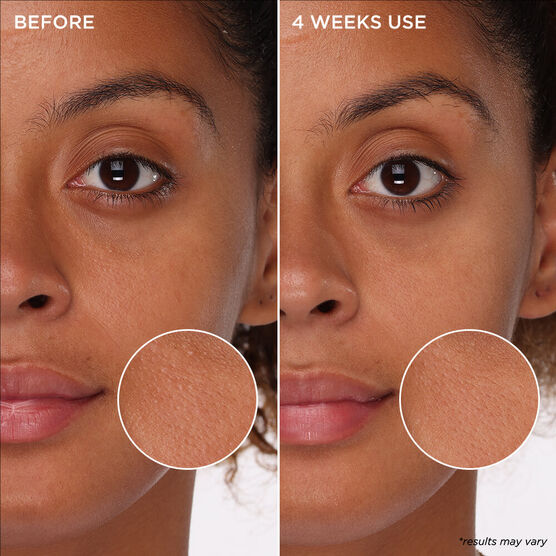 PORE CARE MINI T�NICO EM ESPUMA TIGHT N'